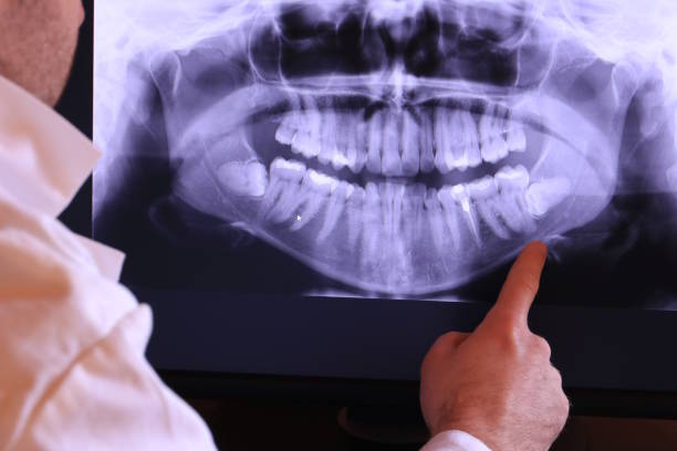 Best Emergency Treatment for Toothache in Silverthorne, CO